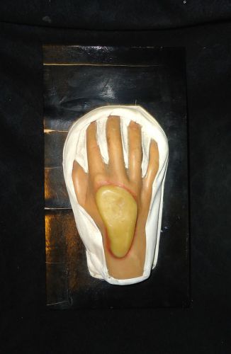 Antique medical wax anatomy model hand pathology moulage - museum - rare! for sale