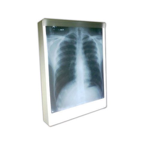 New X-ray Film viewer X-Ray Film Illuminator FREE SHIPPING FOR USA Only