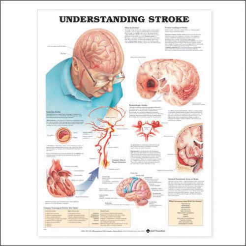Understanding Stroke * Neurology * Anatomy Poster * Anatomical Chart Company