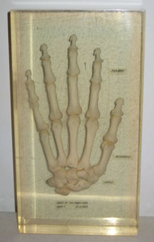 Vintage Ward&#039;s Bones of the Human Hand Skeletal Display Model in Acrylic Case