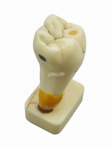 New dental 4times natural pathological teeth model teaching study model g097 pt for sale