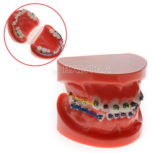 1 Pcs New Dental Teeth Malocclusion Correct With Tooth Hoop Standard Model 3005
