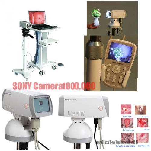 New 1,000,000 pixel sony camera image digital electronic colposcope gynaecology for sale