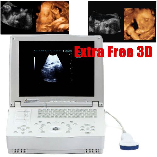 New promolaptop/portable ultrasound scanner machine + convex probe &amp; extra 3d sw for sale