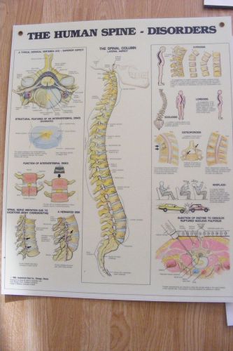 vintage Human Spine Disorders Anatomical Chart  hard plastic
