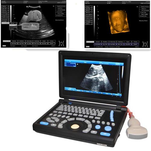 2014 full digital 10.4&#034; tft lcd 3d pc ultrasound scanner high-resolution convex for sale