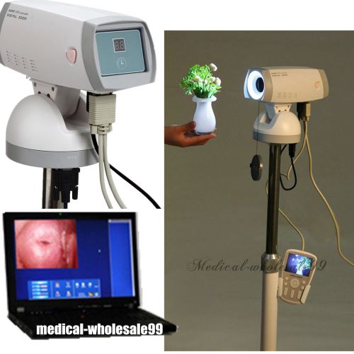 Brand new digital electronic colposcope gynaecology 1 million pixel sony camera for sale