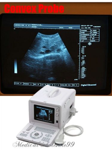 New 3D Software B Ultrasound Scanner/Machine with Convex Probe