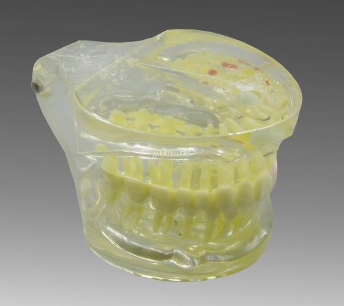 New dental study teeth model pathological teeth model for adult g218 pt for sale