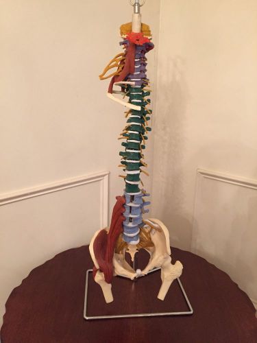 Muscle Spine Anatomy Model with Disorders With Stand Free Shipping