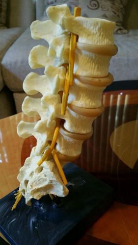 Vertebrae model