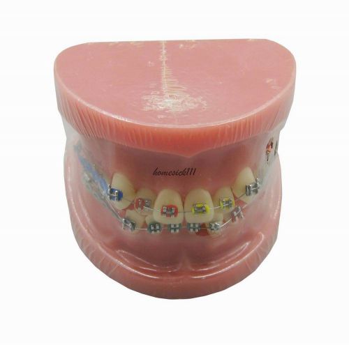 XINGXING Orthodontic Treatment Model With Ortho Bracket and Arch Wire 3005  HO