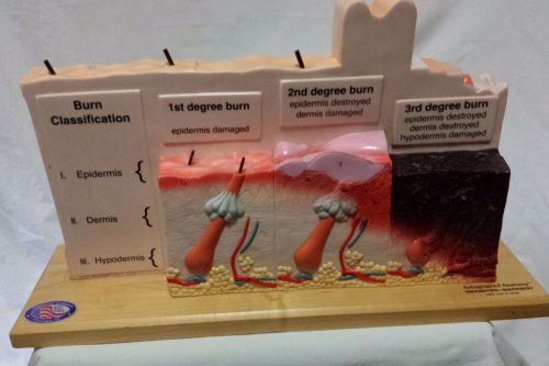 ANATOMY Model Human Skin Plus Denoyer Geppert Burn PATHOLOGIES